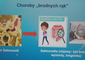 Choroby "brudnych rąk".